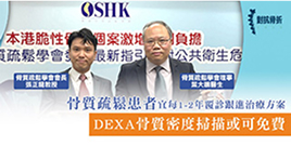 DEXA骨質密度掃描或可免費 骨質疏鬆患者宜每1-2年覆診跟進治療方案