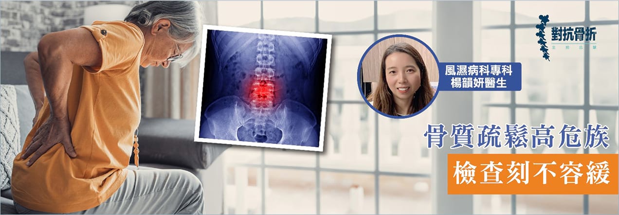 骨質疏鬆高危族 檢查刻不容緩