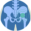Blog18_Hip fracture