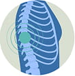 Blog18_Spine fracture