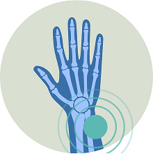 Blog18_Wrist fracture