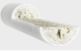 骨質密度偏低
